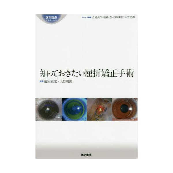 書籍: 知っておきたい屈折矯正手術 [眼科臨床エキスパート]: 医学書院