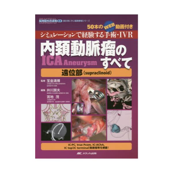 書籍: 内頚動脈瘤〈ICA Aneurysm〉のすべて遠位部〈supraclinoid