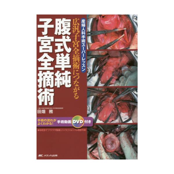 広汎子宮全摘出術 産婦人科手術スーパーレッスン/ハイビジョン&DVD動画 