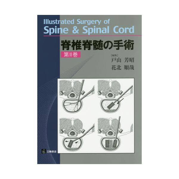 書籍: 脊椎脊髄の手術 第2巻: 三輪書店｜キャラアニ.com