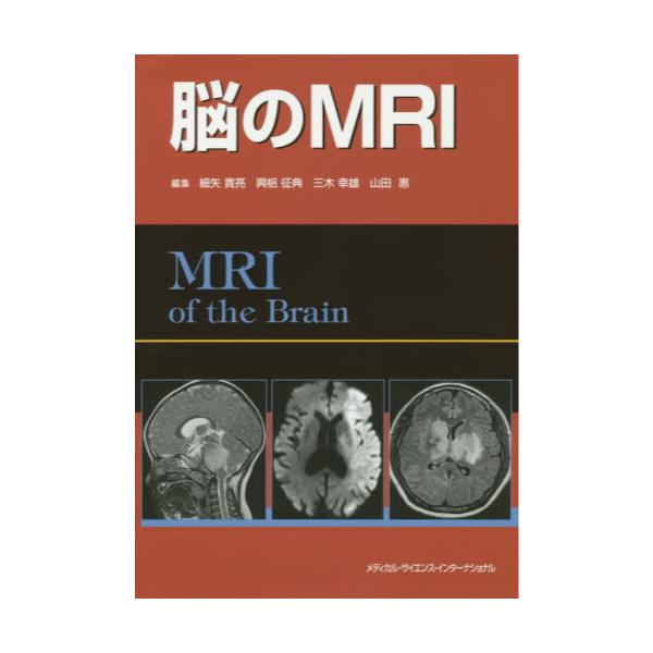 ]MRI