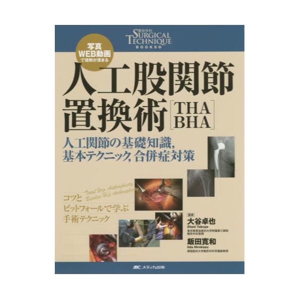 書籍: 人工股関節置換術〈THA・BHA〉 人工関節の基礎知識,基本 書籍: 人工股関節置換術〈THA・BHA〉 人工関節の基礎知識,基本