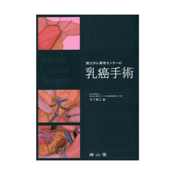 書籍: 国立がん研究センターの乳癌手術: 南山堂｜キャラアニ.com