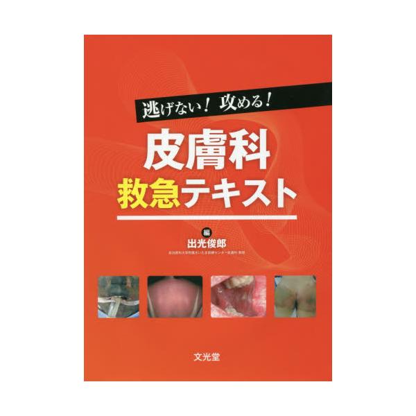 書籍: 逃げない！攻める！皮膚科救急テキスト: 文光堂｜キャラアニ.com