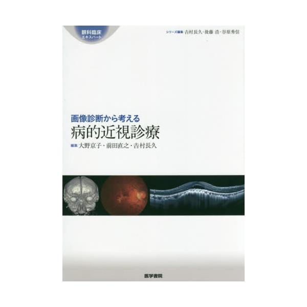 書籍: 画像診断から考える病的近視診療 [眼科臨床エキスパート]: 医学