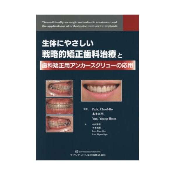 書籍: 生体にやさしい戦略的矯正歯科治療と歯科矯正用アンカー