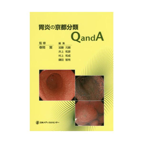書籍: 胃炎の京都分類Q and A: 日本メディカルセンター｜キャラアニ.com