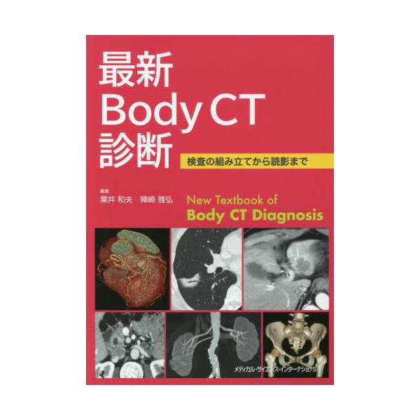 書籍: 最新Body CT診断 検査の組み立てから読影まで: メディカル