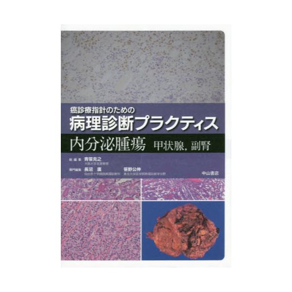 書籍: 内分泌腫瘍 甲状腺，副腎 [癌診療指針のための病理診断