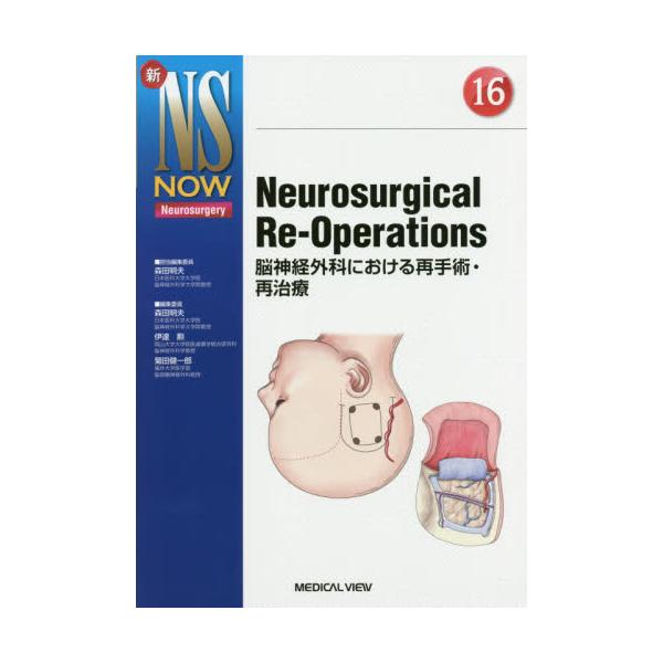 Neurosurgical@Re]Operations@]_oOȂɂĎpEĎÁ@[VNS@NOW@Neurosurgery@16]
