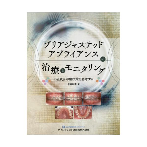 書籍: プリアジャステッドアプライアンスの治療とモニタリング 不正