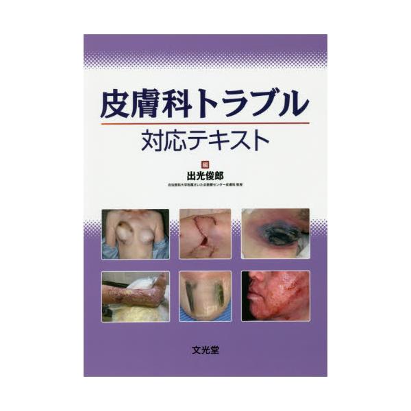 書籍: 皮膚科トラブル対応テキスト: 文光堂｜キャラアニ.com