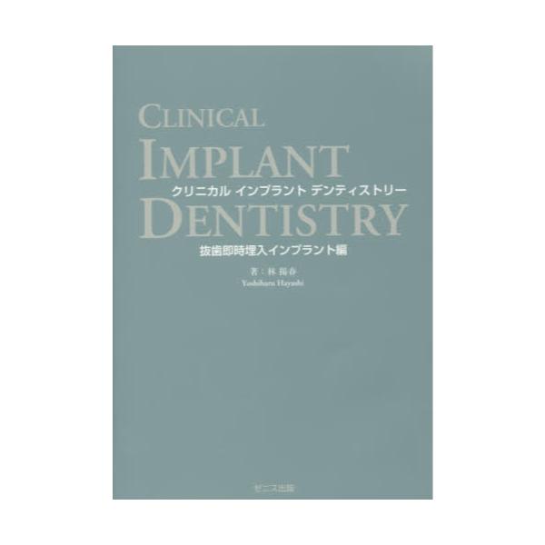 クリニカル インプラント デンティストリー 抜歯即時埋入インプラント