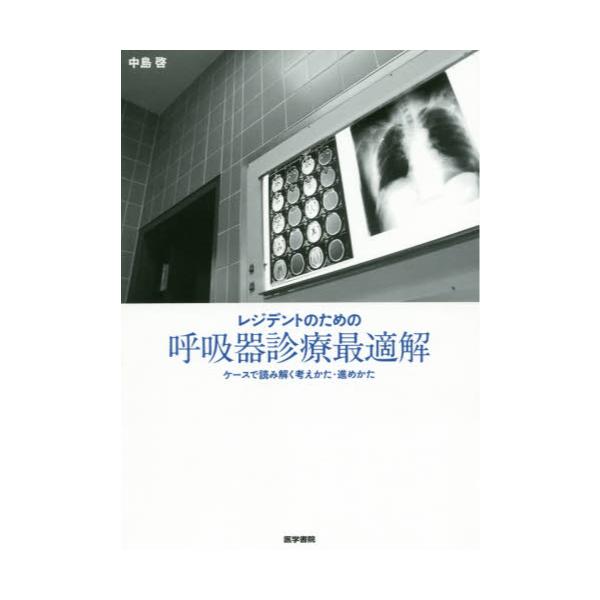 書籍: レジデントのための呼吸器診療最適解 ケースで読み解く考えかた