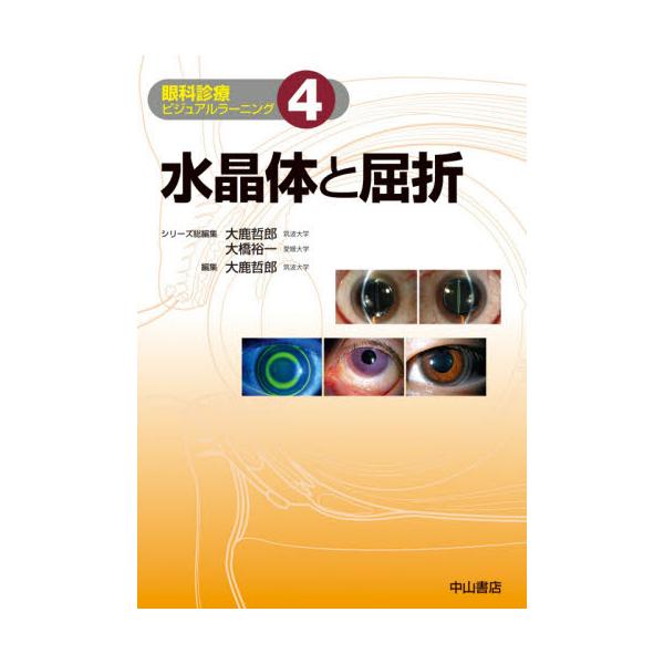 書籍: 眼科診療ビジュアルラーニング 4: 中山書店｜キャラアニ.com