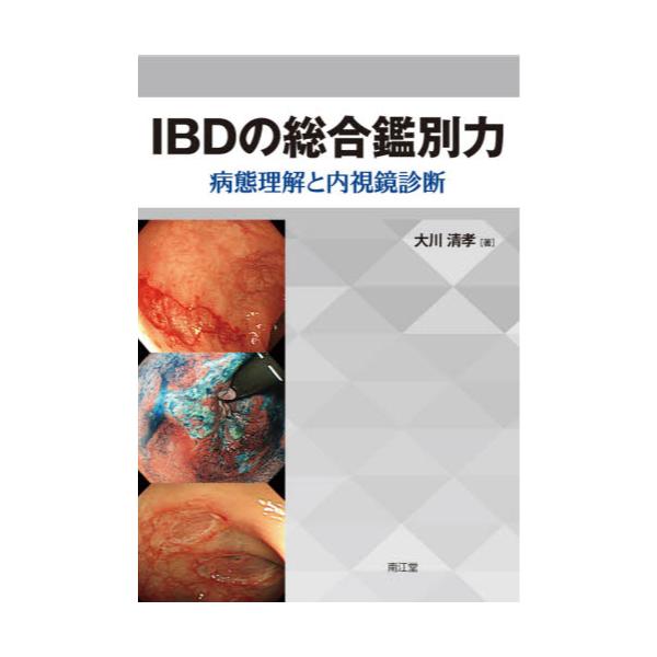 IBDの総合鑑別力 病態理解と内視鏡診断 - 本