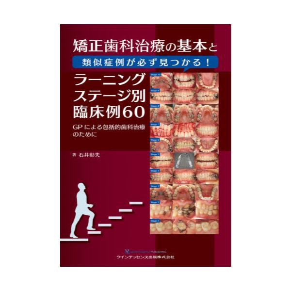 書籍: 矯正歯科治療の基本と類似症例が必ず見つかる！ラーニング