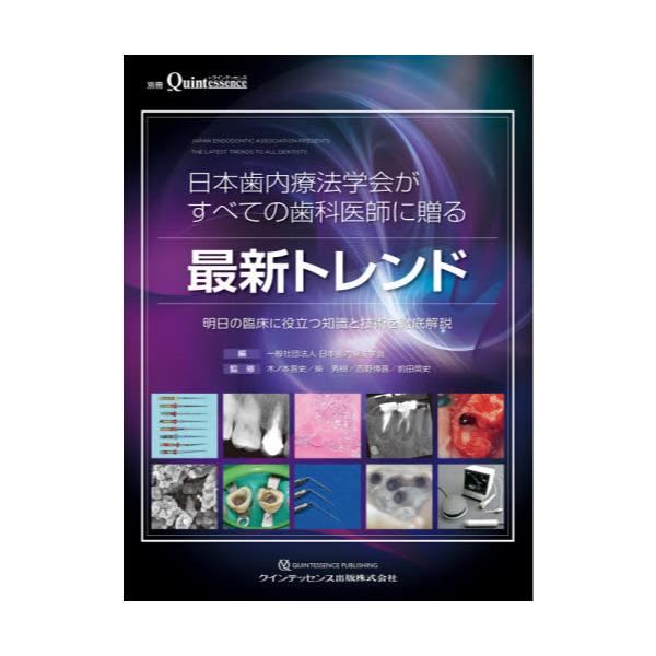 書籍: 日本歯内療法学会がすべての歯科医師に贈る最新トレンド 明日の