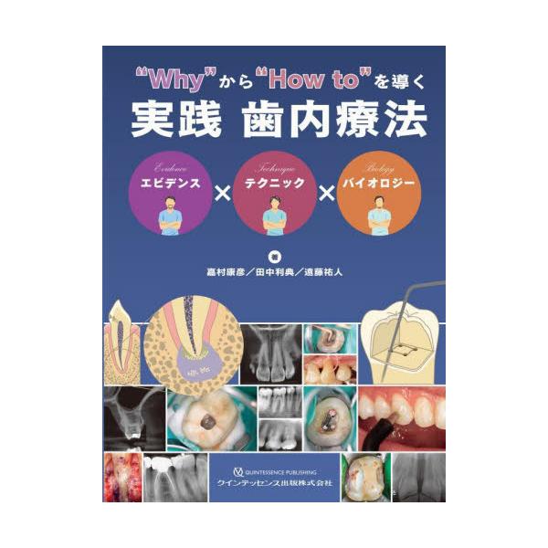 書籍: “Why”から“How to”を導く実践歯内療法 エビデンス× 