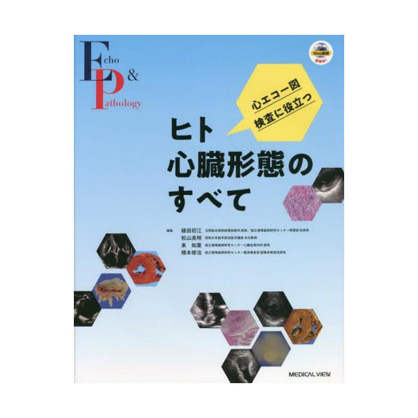 書籍: 心エコー図検査に役立つヒト心臓形態のすべて: メジカルビュー社