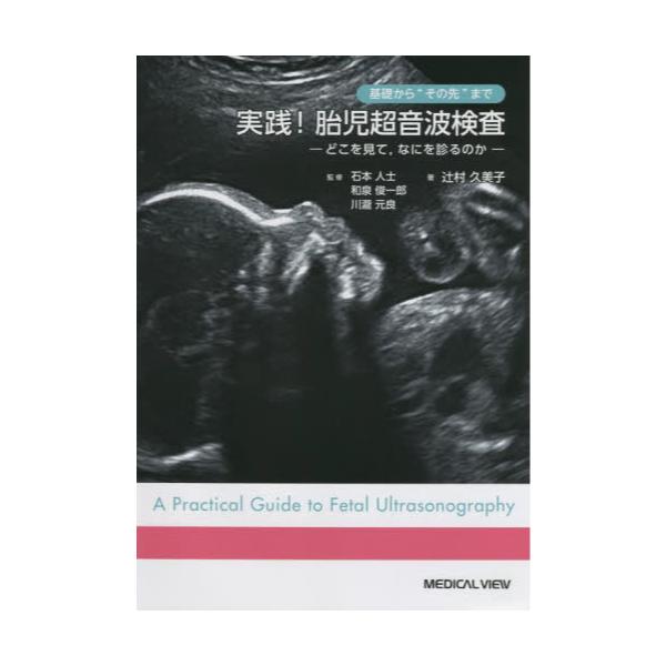 書籍: 基礎から“その先”まで実践！胎児超音波検査 どこを見て，なにを