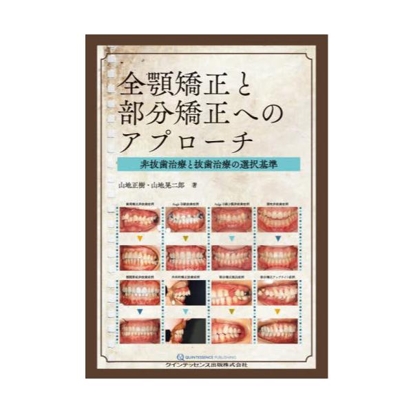 書籍: 全顎矯正と部分矯正へのアプローチ 非抜歯治療と抜歯治療の選択