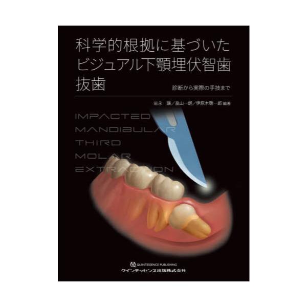 書籍: 科学的根拠に基づいたビジュアル下顎埋伏智歯抜歯 診断から実際 