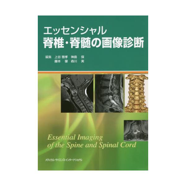 書籍: エッセンシャル脊椎・脊髄の画像診断: メディカル・サイエンス 