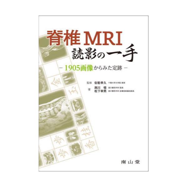 書籍: 脊椎MRI読影の一手 1905画像からみた定跡: 南山堂｜キャラアニ.com