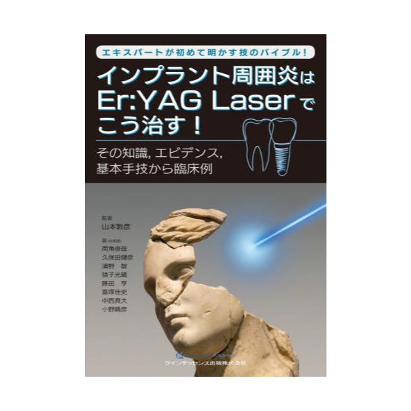 インプラント周囲炎はEr：YAG Laserでこう治す! エキスパートが初めて 