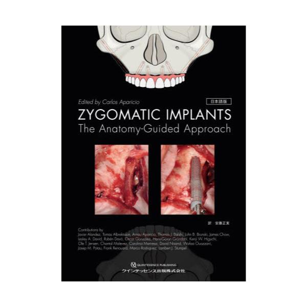 書籍: ZYGOMATIC IMPLANTS The Anatomy‐Guided Approach 日本語版 