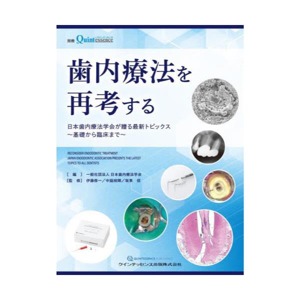 書籍: 歯内療法を再考する 日本歯内療法学会が贈る最新トピックス