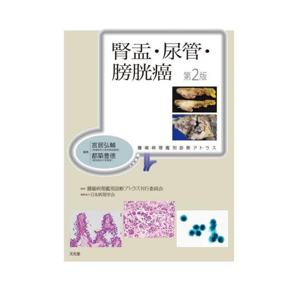 書籍: 腎盂・尿管・膀胱癌 [腫瘍病理鑑別診断アトラス]: 文光堂