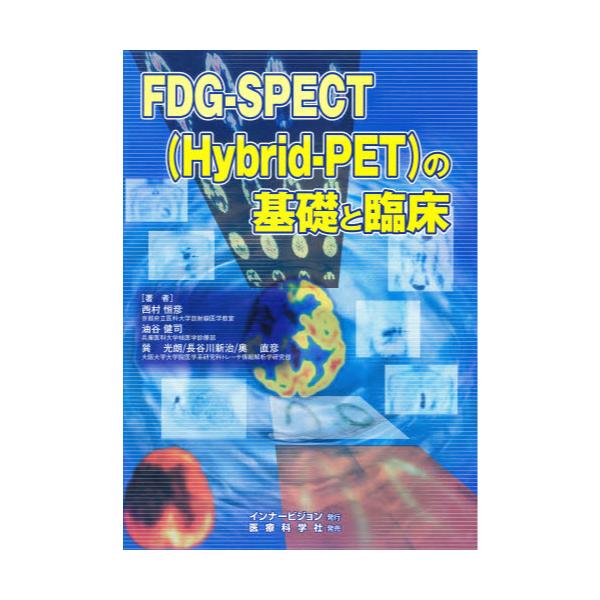 FDG|SPECTiHybrid|PET