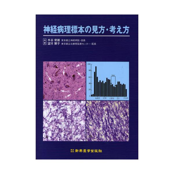 書籍: 神経病理標本の見方・考え方: 新興医学出版社｜キャラアニ.com