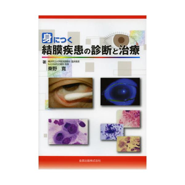 書籍: 身につく結膜疾患の診断と治療 [身につく]: 金原出版