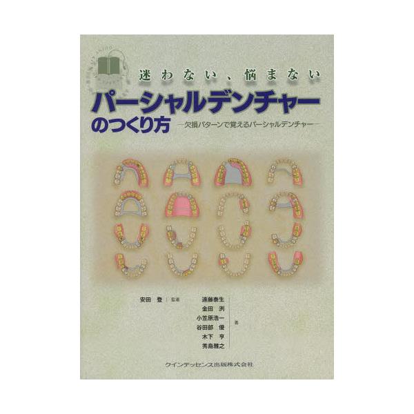 書籍: 迷わない、悩まないパーシャルデンチャーのつくり方 欠損